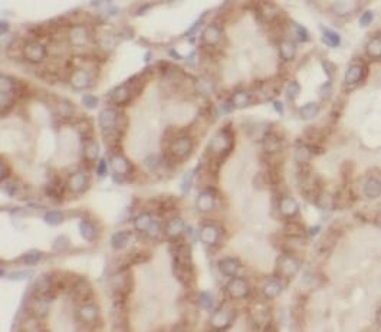 ATG2A Rabbit Polyclonal Antibody