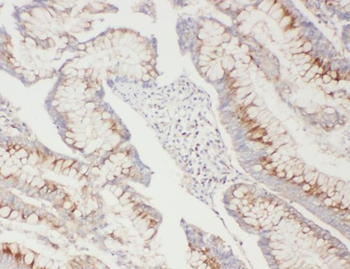 ATG5 Antibody