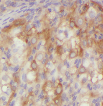 ATN1 Antibody