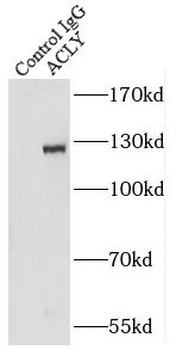 ACLY Antibody