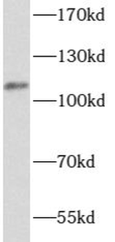 ATP12A Rabbit Polyclonal Antibody