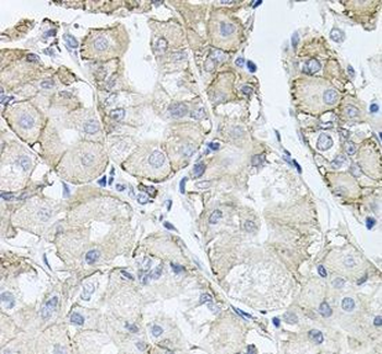 ATP1B1 Antibody