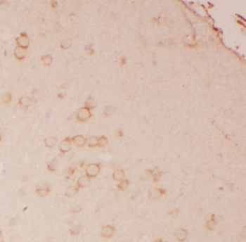 ATP1B2 Antibody