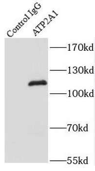 ATP2A1 Rabbit Polyclonal Antibody
