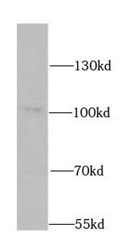 ATP2C1 Rabbit Polyclonal Antibody