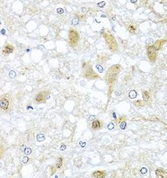 ATP2C1 Rabbit Polyclonal Antibody