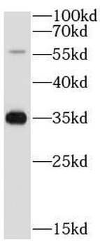 ATP4B Antibody