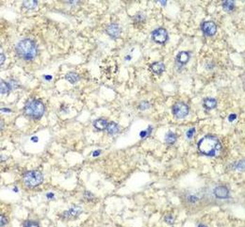 ATP5F1A Antibody