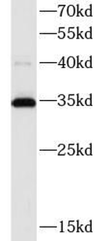 ATP5F1C Antibody