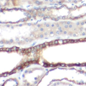 ATP5F1C Antibody