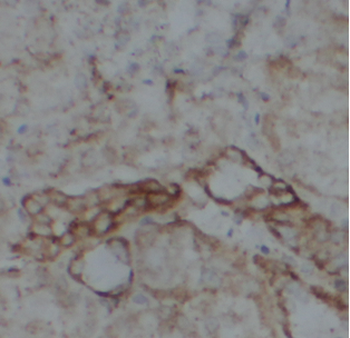 ATP5F1D Antibody