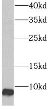 ATP5ME Antibody
