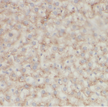 ATP5ME Antibody