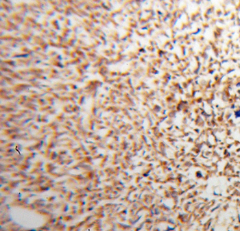 ATP5PF Antibody