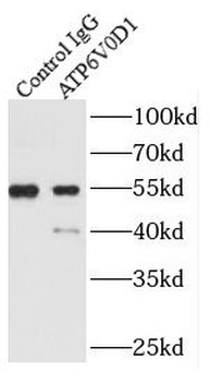 ATP6V0D1 Antibody