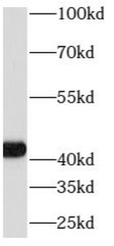 ATP6V0D1 Antibody