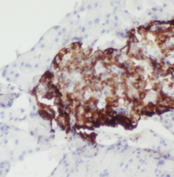 ATP6V1A Antibody