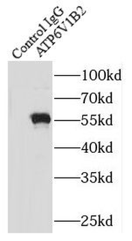 ATP6V1B2 Antibody