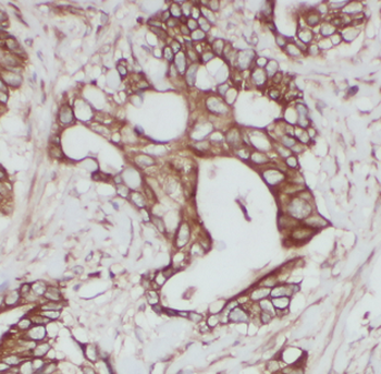 ATP6V1B2 Antibody