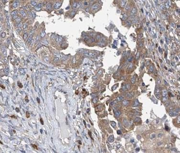 ATP6V1C1 Antibody