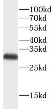 ATP6V1E1 Antibody