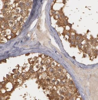 ATP6V1E1 Antibody