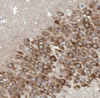 ATP6V1G2 Antibody