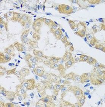 ATP5IF1 Antibody