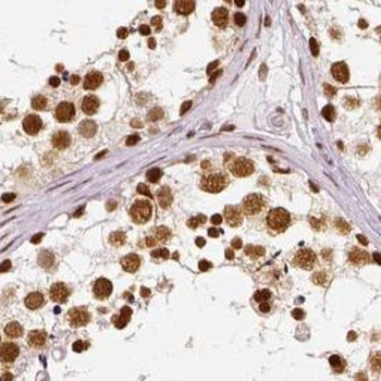 ATR Rabbit Polyclonal Antibody