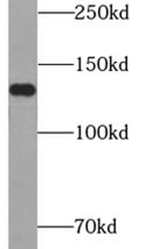 ATXN2L Rabbit Polyclonal Antibody