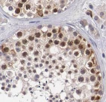 ATXN3L Antibody