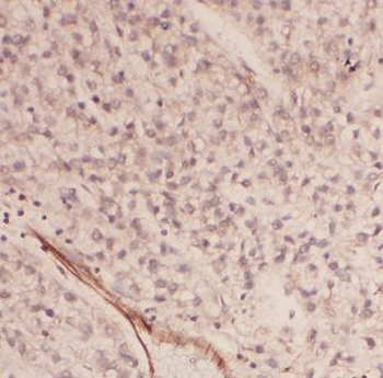 AUP1 Antibody