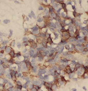 AURKA Antibody