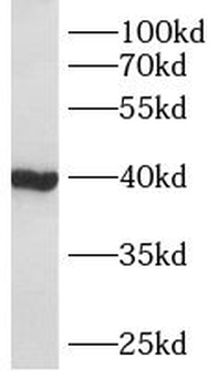 AWAT2 Antibody