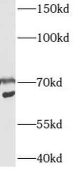 CSRNP1 Antibody