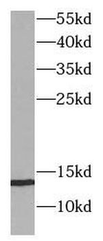 B2M Mouse Monoclonal Antibody