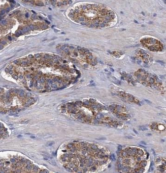 B2M Mouse Monoclonal Antibody