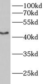B3GALT2 Antibody