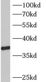 B3GALT6 Antibody
