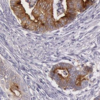 B3GLCT Antibody