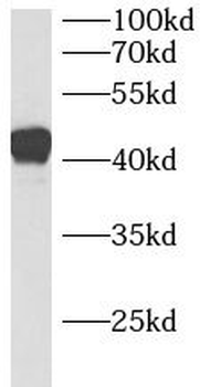 B3GNT3 Rabbit Polyclonal Antibody