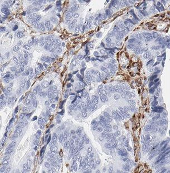 B4GALT2 Antibody