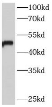 B4GALT6 Antibody