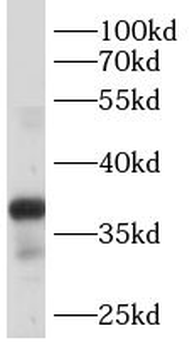 B4GALT7 Antibody
