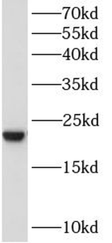 BAALC Antibody
