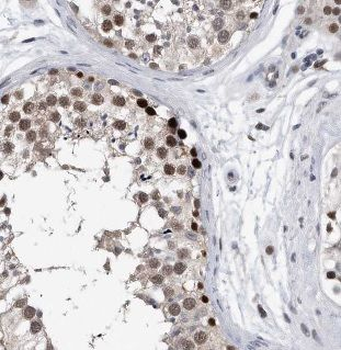 BAALC Antibody