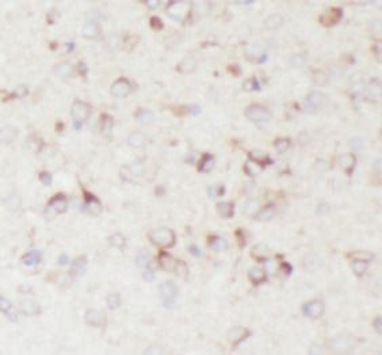 BACE1 Antibody