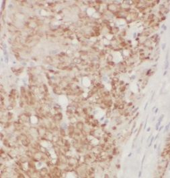 BACE2 Rabbit Polyclonal Antibody