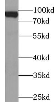 BACH1 Rabbit Polyclonal Antibody