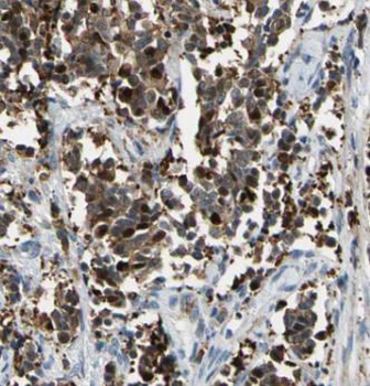 BACH1 Antibody